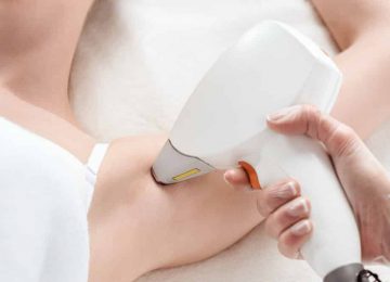 הסרת שיער בלייזר למה כדאי לעשות אצל מור בראל