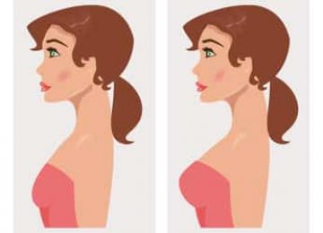 הגדלת חזה ע״י כדורים