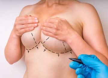 רגע לפני הניתוח – איזה שתלים הכי טובים