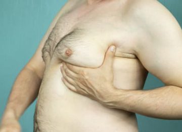 גניקומסטיה ללא ניתוח – כיצד מתבצע התהליך