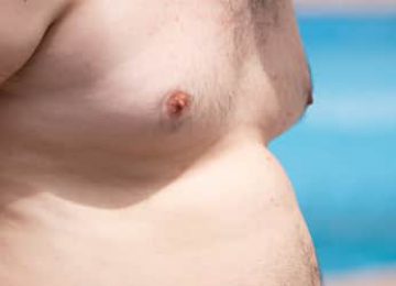 גניקומסטיה – מחיר וטיפולים שאותם ניתן לבצע